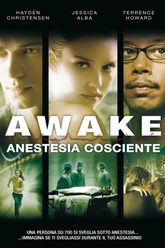 Awake -anestesia cosciente-