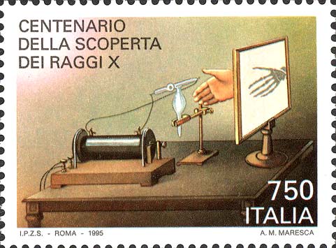 Francobollo Radiografia di una Mano -  1995